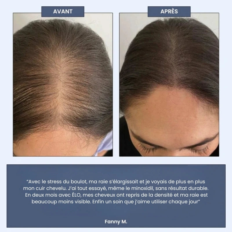 Sérum Roll-on Cheveux