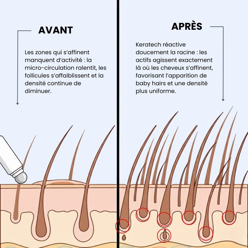 Sérum Roll-on Cheveux