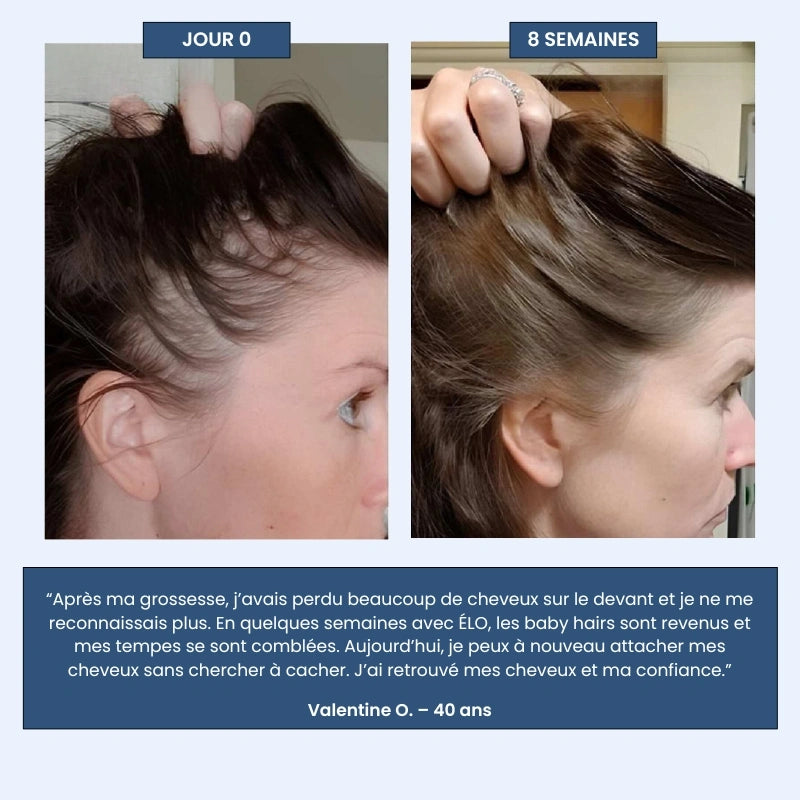 Sérum Roll-on Cheveux