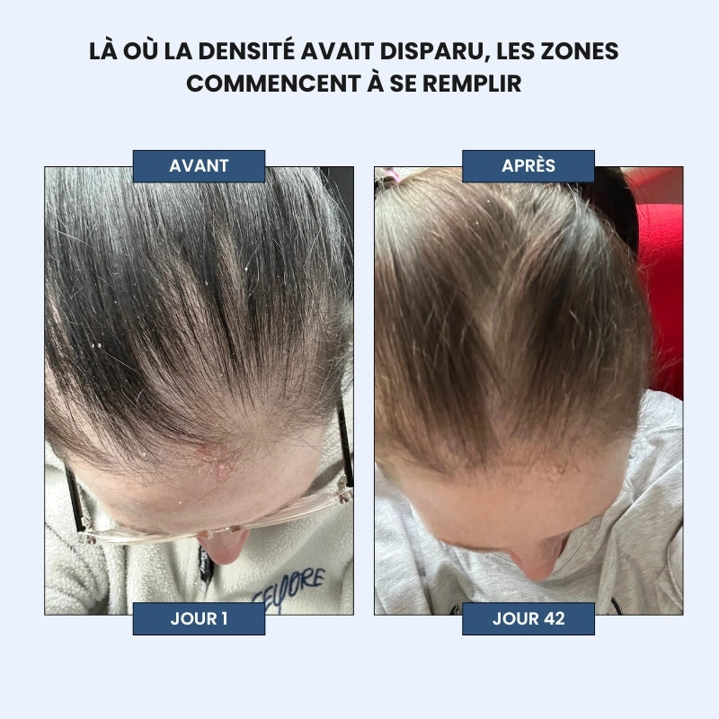 Élo - Moins de chute, plus de confiance