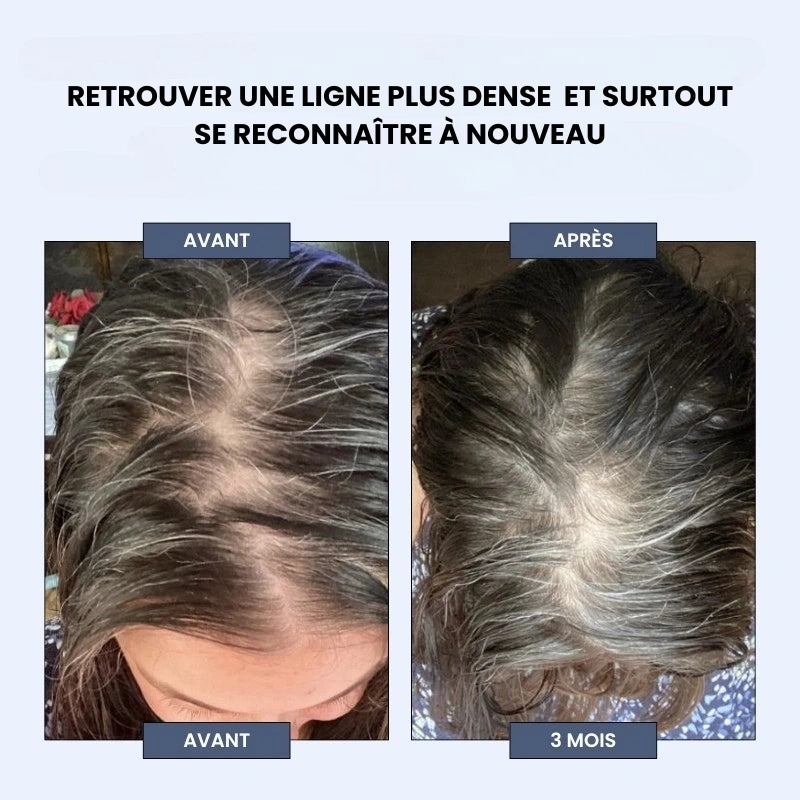 Élo - Moins de chute, plus de confiance