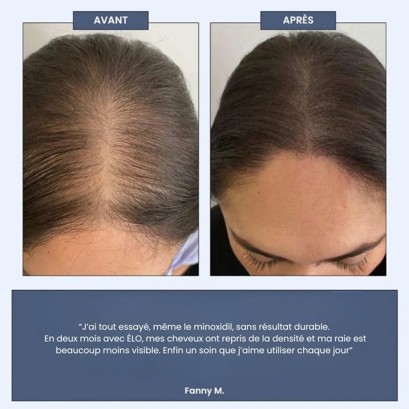 Élo - Moins de chute, plus de confiance