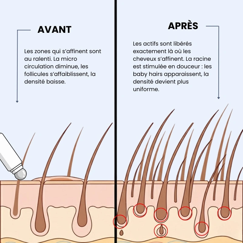 Élo - Moins de chute, plus de confiance